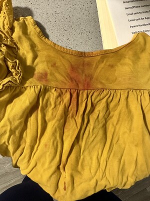 Family Sues Lewisville Daycare Center for Negligence After 2-Year-Old's Severe Fall