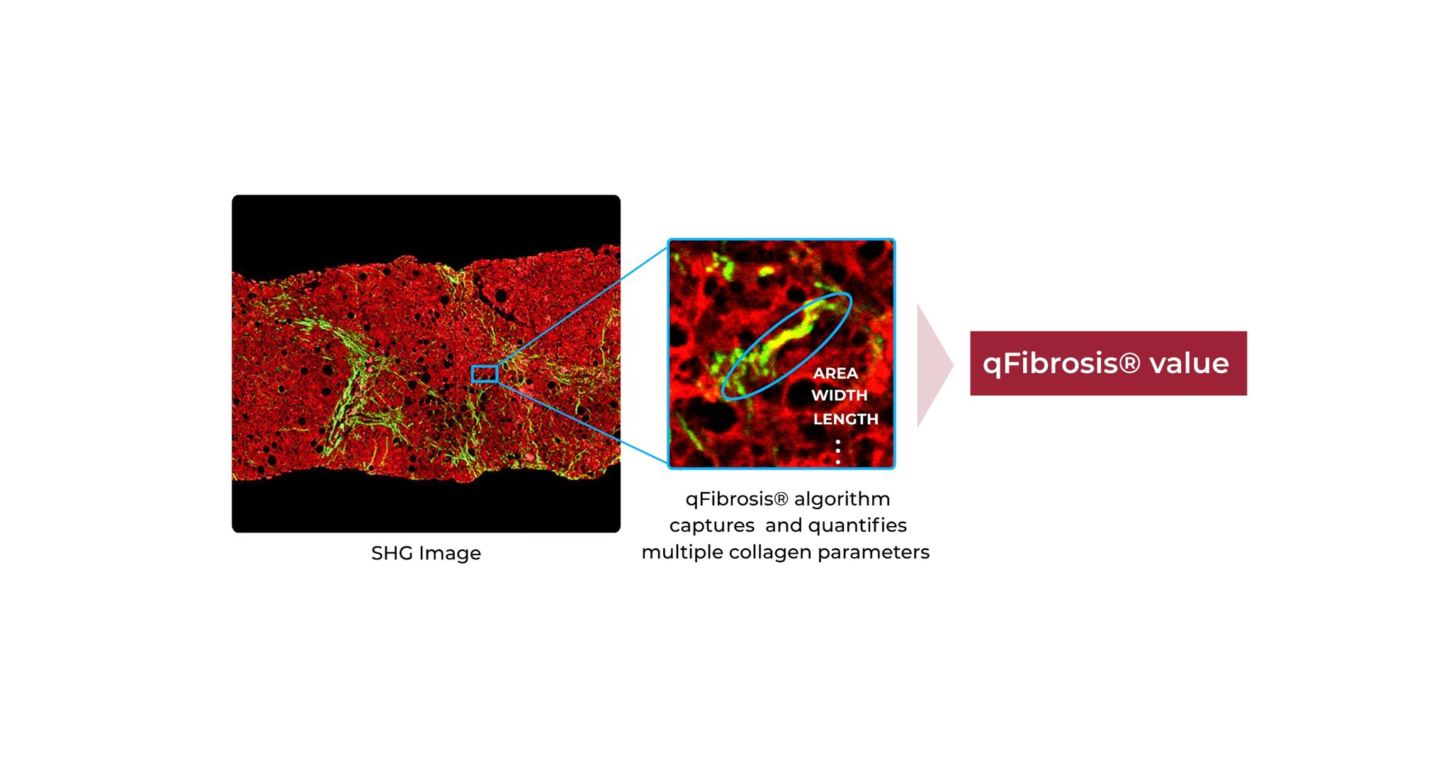 HistoIndex Marks Another Step Forward with FibroSIGHT&trade; Plus: Introducing AI-based Quantitative Analysis in Fibrosis Assessment