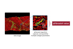 HistoIndex Marks Another Step Forward with FibroSIGHT™ Plus: Introducing AI-based Quantitative Analysis in Fibrosis Assessment