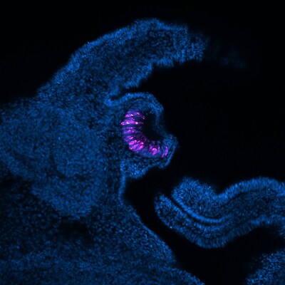 Apple Snail eye embryo under microscope.