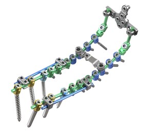 ulrich medical USA® Announces Full Market Launch of Cortium® Universal OCT Spinal Fixation System
