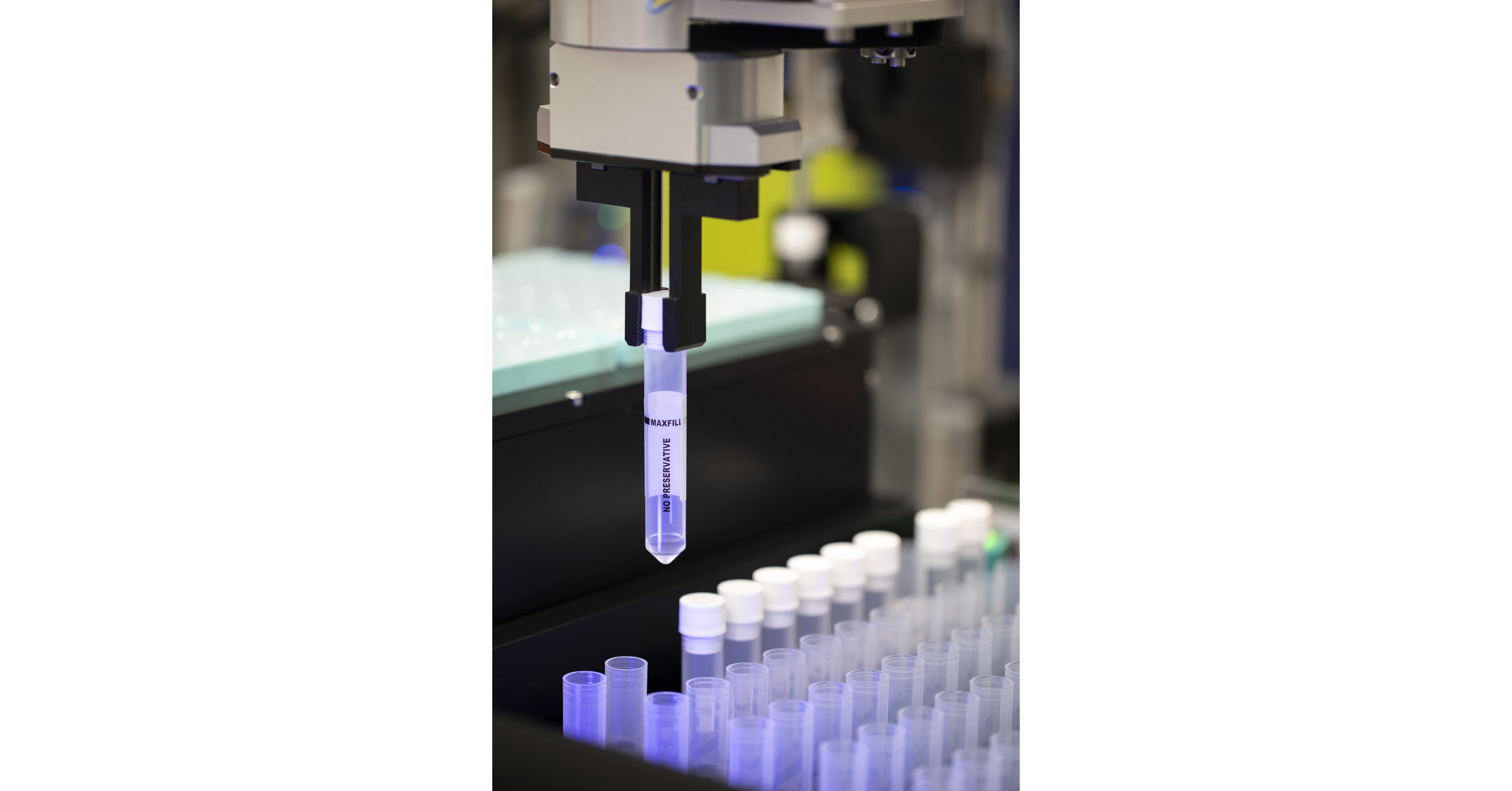 Copan Launches UriVerse&trade;: Fully Automated Solution for Urine Specimen Aliquoting