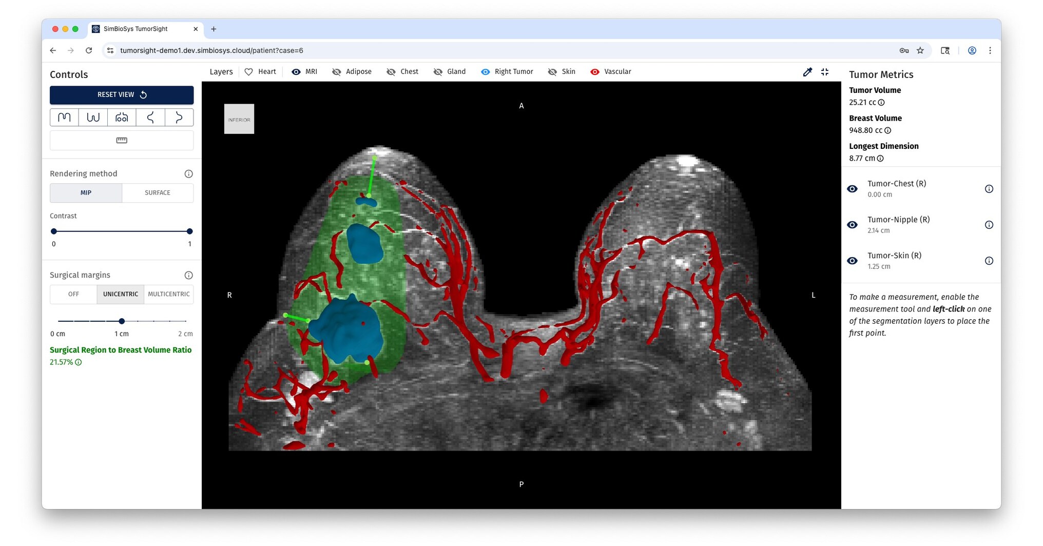 SimBioSys and Ricoh 3D for Healthcare announce strategic alliance ...