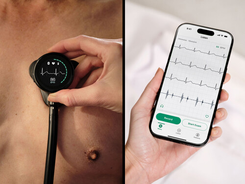 Company leadership to highlight strategic vision, AI-powered cardiovascular detection, and long-term growth opportunities Company leadership to highlight strategic vision, AI-powered cardiovascular detection, and long-term growth opportunities