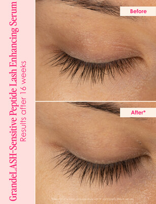 Before and after * In a 16 week consumer study using GrandeLASH-Sensitive - 96% saw thicker looking lashes, 93% saw stronger, healthier, longer-looking lashes and 96% said serum didn’t irritate eyes or cause redness 100% saw less lash fall out.