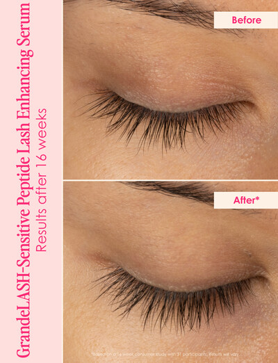 Before and after * In a 16 week consumer study using GrandeLASH-Sensitive - 96% saw thicker looking lashes, 93% saw stronger, healthier, longer-looking lashes and 96% said serum didn’t irritate eyes or cause redness 100% saw less lash fall out.