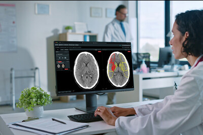Brainomix 360 Stroke provides real-time interpretation of brain scans to help guide treatment and transfer decisions for stroke patients. Brainomix 360 Stroke provides real-time interpretation of brain scans to help guide treatment and transfer decisions for stroke patients.