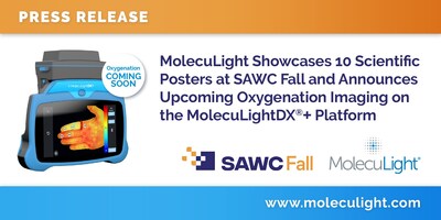 MolecuLight Showcases 10 Scientific Posters at SAWC Fall and Announces Upcoming Oxygenation Imaging on the MolecuLightDX®+ Platform MolecuLight Showcases 10 Scientific Posters at SAWC Fall and Announces Upcoming Oxygenation Imaging on the MolecuLightDX®+ Platform