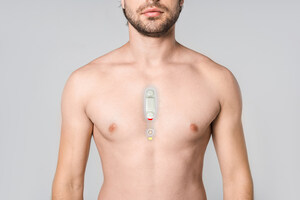 Vivalink Introduces New Adhesive for Wearable ECG to Enhance Ambulatory Cardiac Monitoring and Clinical Research