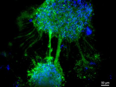 VitroGel® NEURON supports 3D NSC differentiation into dopaminergic neurons and promotes neurite and axonal outgrowth.