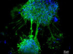 TheWell Bioscience Launches VitroGel® NEURON, a First-Of-Its-Kind Synthetic Hydrogel for Superior 3D, 2D Neuronal Cell Culture and Beyond