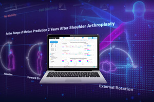 Exactech Unveils First Large-Scale CT Radiomic Analysis of Shoulder Bones and Muscles, Establishing the Foundation for the Future of Personalized Pre-Operative Planning