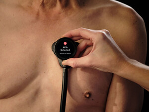 AI-Enabled Eko Health Stethoscope TRICORDER Trial Marks Historic Leap in Early Heart Disease Detection