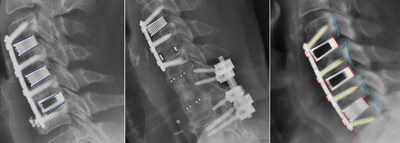 Sample radiographs from cohort