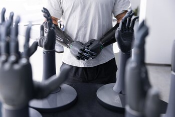 Ni wearing a bionic hand