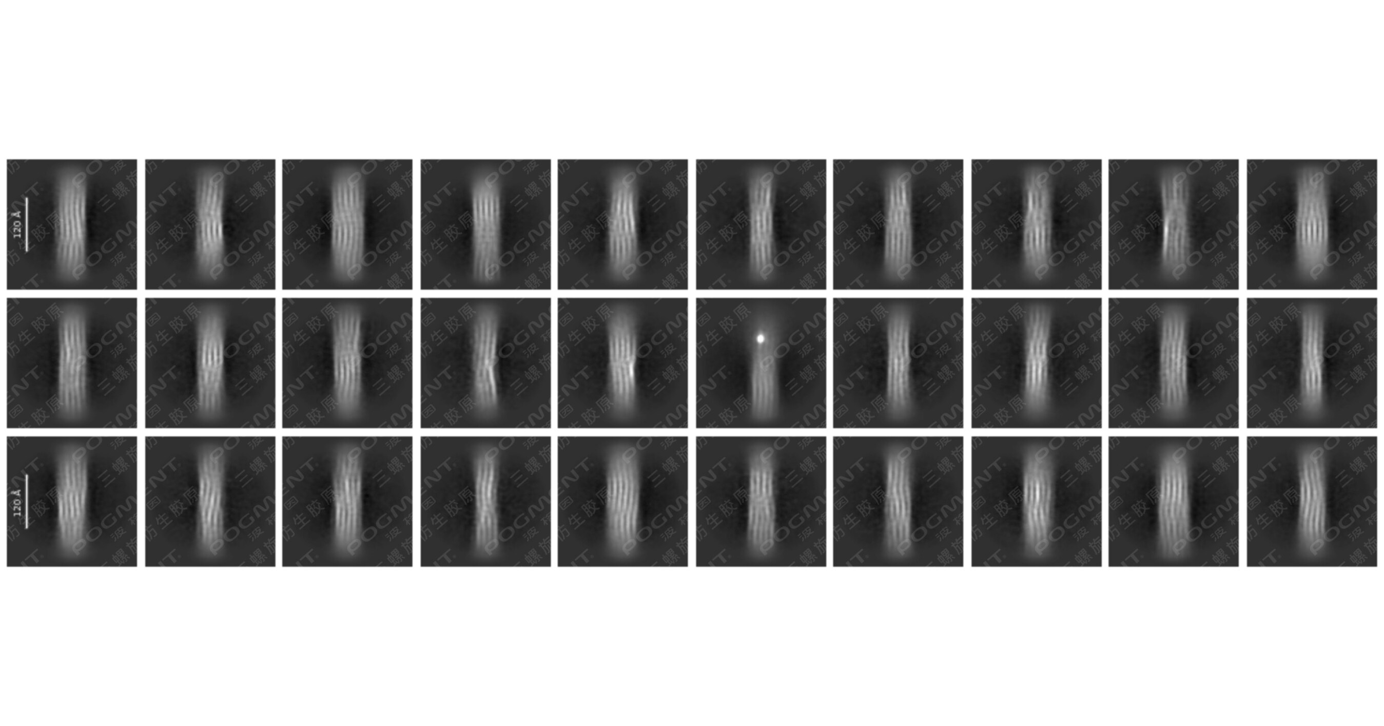 GLOBAL FIRST High-Definition Image: Decoding the Code of Youth - LivingPhoenixs POGMENT Collagen Breakthrough Fills Global Gap