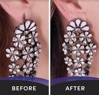 Lobe Miracle - Before and After