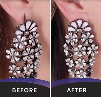 Lobe Miracle - Before and After