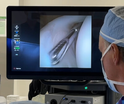 The NanoNeedle™ scope 2.0, the latest version of the company’s minimally invasive imaging platform, was recently used for the first time in a clinical case by Kyle Anderson, MD, at Anderson Sports Medicine in Bingham Farms, Michigan.