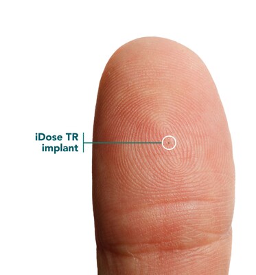 The size of an iDose implant.
