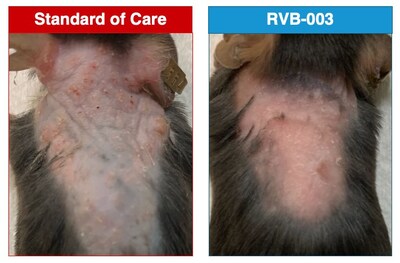 Representative images of Netherton Syndrome mice treated daily with either standard of care (left) or RVB-003 (right). Mice treated with RVB-003 show resolution of excessive protease activity, normalization of inflammation, and ultimately a restoration of a healthy skin barrier.