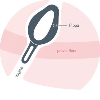 Graphic representation of anatomical cross-section (intra-vaginal placement)
