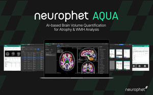 Neurophet Publishes Clinical Validation Results of 'Neurophet AQUA' in Annals Academy of Medicine Singapore