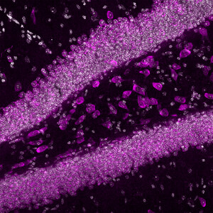 Mercury Bio Reports Positive Results from Preclinical Study Evaluating Novel Drug Delivery Technology Transporting Protein Cargo to the Brain