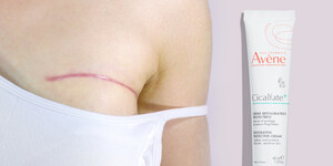 A Partnership for Impact: Eau Thermale Avène and Breast Cancer Alliance