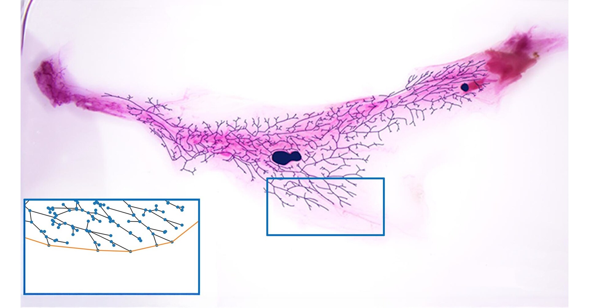 The magnetic math of breast health