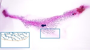 The magnetic math of breast health