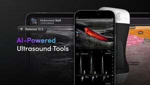 Clarius Mobile Health Updates App with AI-Powered Ultrasound Tools for Physiotherapists, Plastic Surgeons and Medical Education