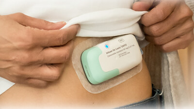 Lasix ONYU Infusor on a Patient