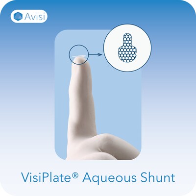 Avisi Technologies’ VisiPlate® is an ultrathin, multichannel, aqueous shunt with an innovative composition made from a metamaterial and designed to treat glaucoma by managing Intraocular pressure (IOP).