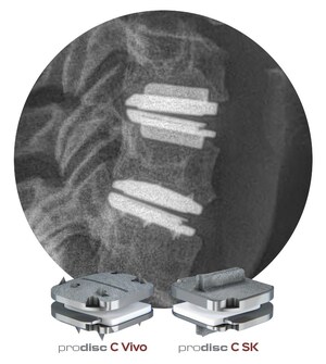 Centinel Spine® Receives Two-Level FDA Approval for prodisc® C Vivo and prodisc® C SK Match-the-Disc™ Cervical Total Disc Replacement Devices