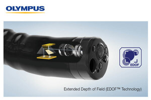 Olympus Canada Inc. Announces Launch of Advanced Imaging Endoscopes as Part of the EVIS X1™ Endoscopy System