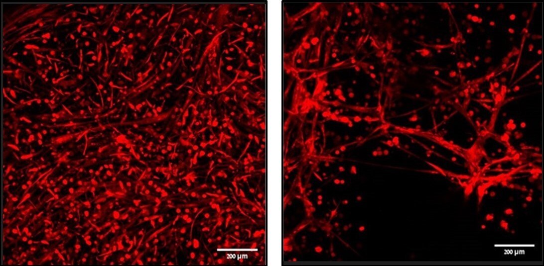 CollPlant's rhCollagen-Based BioInk Demonstrates Strong Performance Compared to Matrigel® in Study Conducted by Technion - Israel Institute of Technology