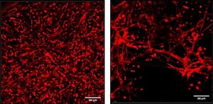 CollPlant's rhCollagen-Based BioInk Demonstrates Strong Performance Compared to Matrigel® in Study Conducted by Technion - Israel Institute of Technology