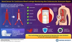 Hanyang University Researchers Develop Novel Sensor for Continuous Endoleak Monitoring