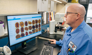 Journal of Clinical Microbiology Publishes Article on ARUP's Validation of AI for Parasite Detection
