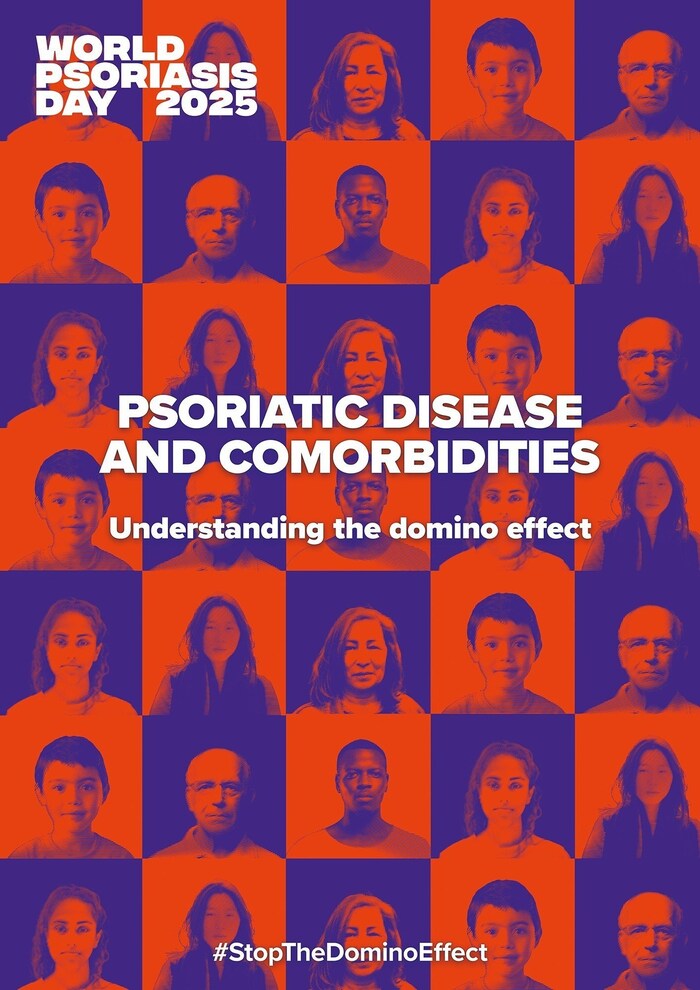 World Psoriasis Day 2025 - campaign main theme (PRNewsfoto/IFPA) World Psoriasis Day 2025 - campaign main theme (PRNewsfoto/IFPA)