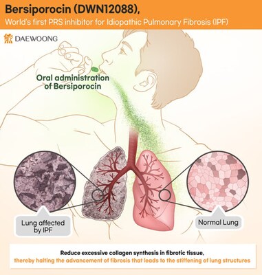 Daewoong Pharmaceutical Third IDMC Reaffirms Safety of Bersiporocin and Recommends Continuation of Global Phase 2 Clinical Trial Daewoong Pharmaceutical Third IDMC Reaffirms Safety of Bersiporocin and Recommends Continuation of Global Phase 2 Clinical Trial