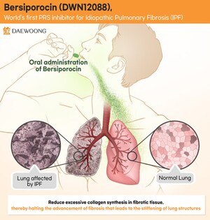 Daewoong Pharmaceutical: Third IDMC Reaffirms Safety of Bersiporocin and Recommends Continuation of Global Phase 2 Clinical Trial Daewoong Pharmaceutical: Third IDMC Reaffirms Safety of Bersiporocin and Recommends Continuation of Global Phase 2 Clinical Trial