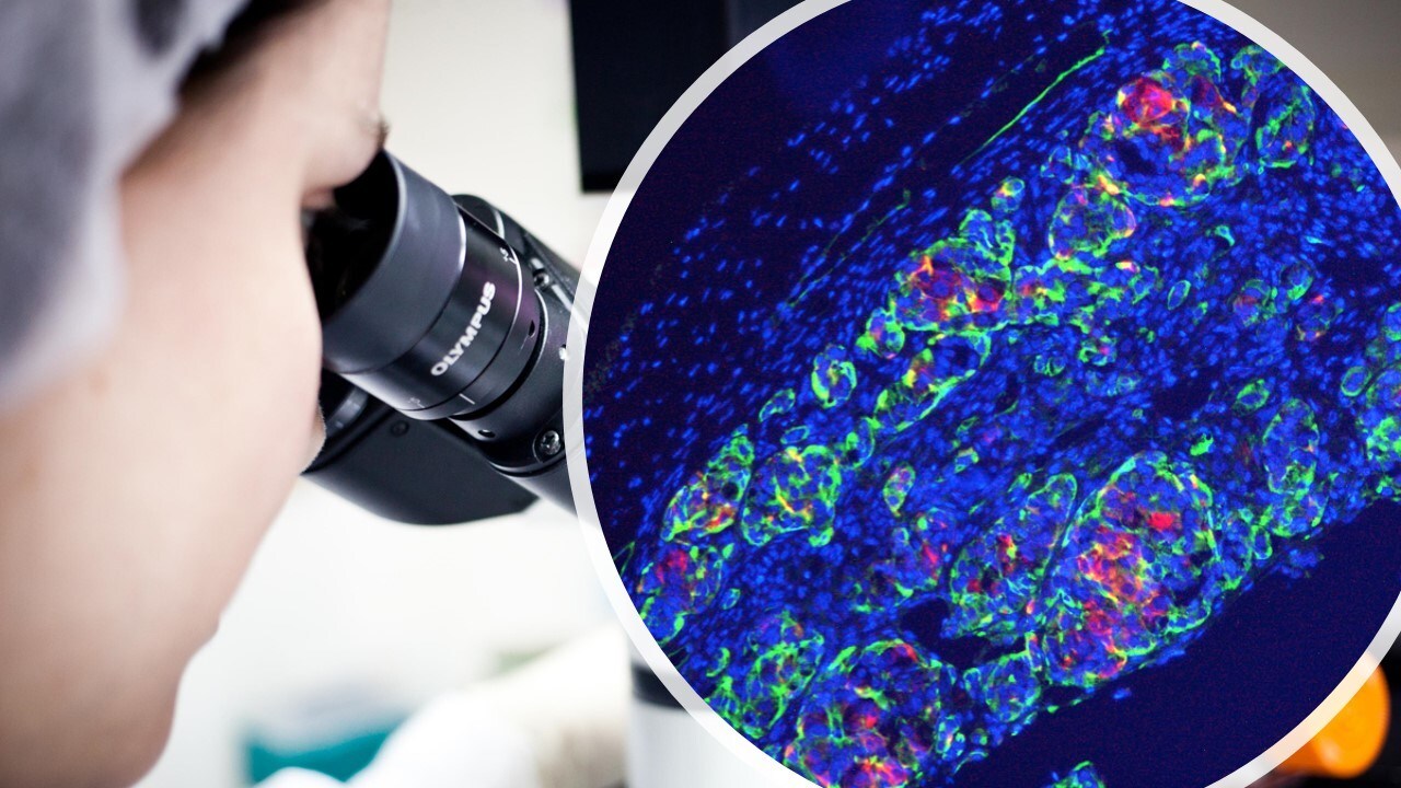 Microscopic look at Kadimastem’s Beta cells