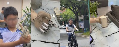 Ma in his daily life with the bionic hand. Ma in his daily life with the bionic hand.