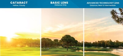 Advanced Technology Lens Advanced Technology Lens