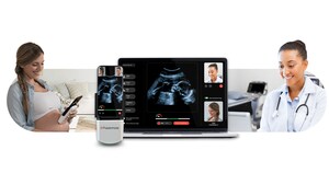Pulsenmore Receives FDA De Novo Marketing Authorization for Home-Use Prenatal Ultrasound, Pioneering a New Era of Prenatal Care in the U.S.