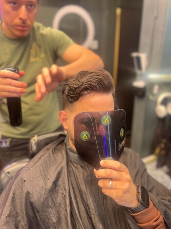 After Photo of Hair System