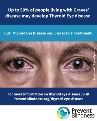 Prevent Blindness declares 6th annual Thyroid Eye Disease Week to raise awareness and provide educational resources to patients and care partners. Prevent Blindness declares 6th annual Thyroid Eye Disease Week to raise awareness and provide educational resources to patients and care partners.