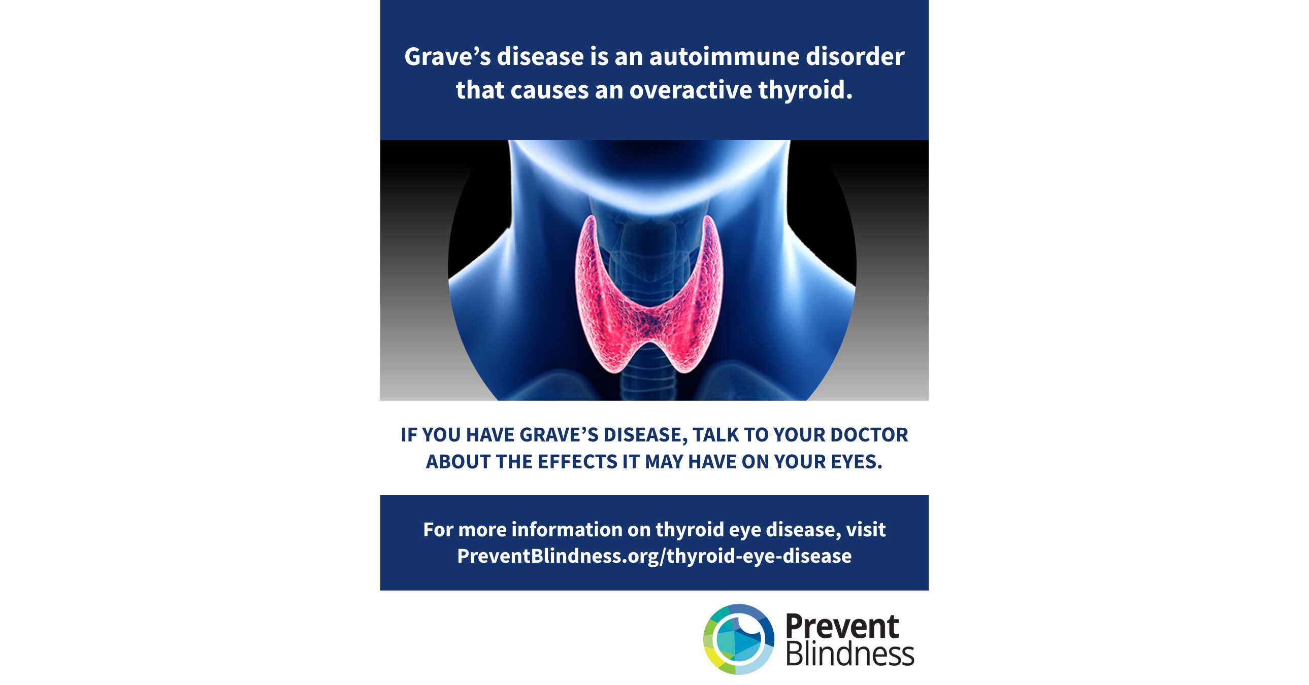 Prevent Blindness Declares Sixth Annual Thyroid Eye Disease (TED) Week to Educate Public on Condition That Can Threaten Sight and Mental Wellness